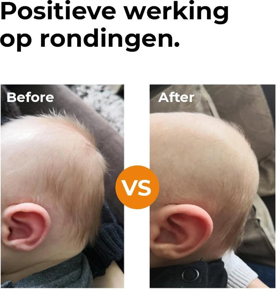 Deryan Ergonomisch Babykussen met Afneembare Hoes - Tegen plat achterhoofd - Hoofdkussen - Traagschuim kussen - Memory foam - Baby Steunkussen - Kraamcadeau Deryan Ergonomisch Babykussen Met Afneembare Hoes - Tegen Plat Achterhoofd - Hoofdkussen - Traagschuim Kussen - Memory Foam - Baby Steunkussen - Kraamcadeau -Babyproducten Promotie Winkel