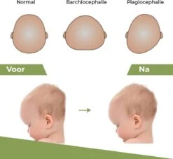 Novalits - Orthopedisch Baby Zijslaapkussen Met Traagschuim En Anti-Allergene Bamboe Microvezel Stof Om Een Plat Hoofd Tegen Te Gaan - Zijligkussen Voor Peuter - Babykussen Zijligging - Rolkussen - Steunkussen - Slaapondersteuning -Babyproducten Promotie Winkel 1200x1103 1