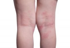 Donttellmum - Eczeem Repair Creme - 50 Ml -Babyproducten Promotie Winkel 1200x818